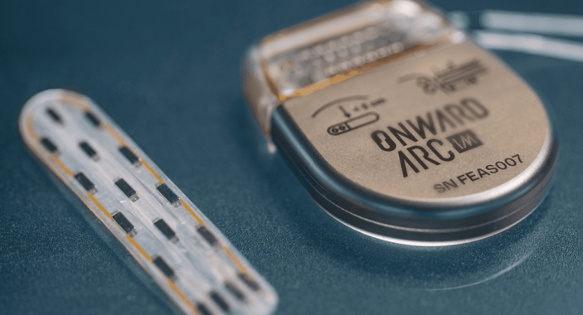 Onward Medical Starts New Study of ARC-IM for Mobility After SCI